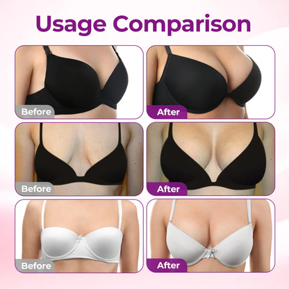 💥Turonu® 💔 Targeted Breast Enhancement Advanced Nano Microneedle Patch💃