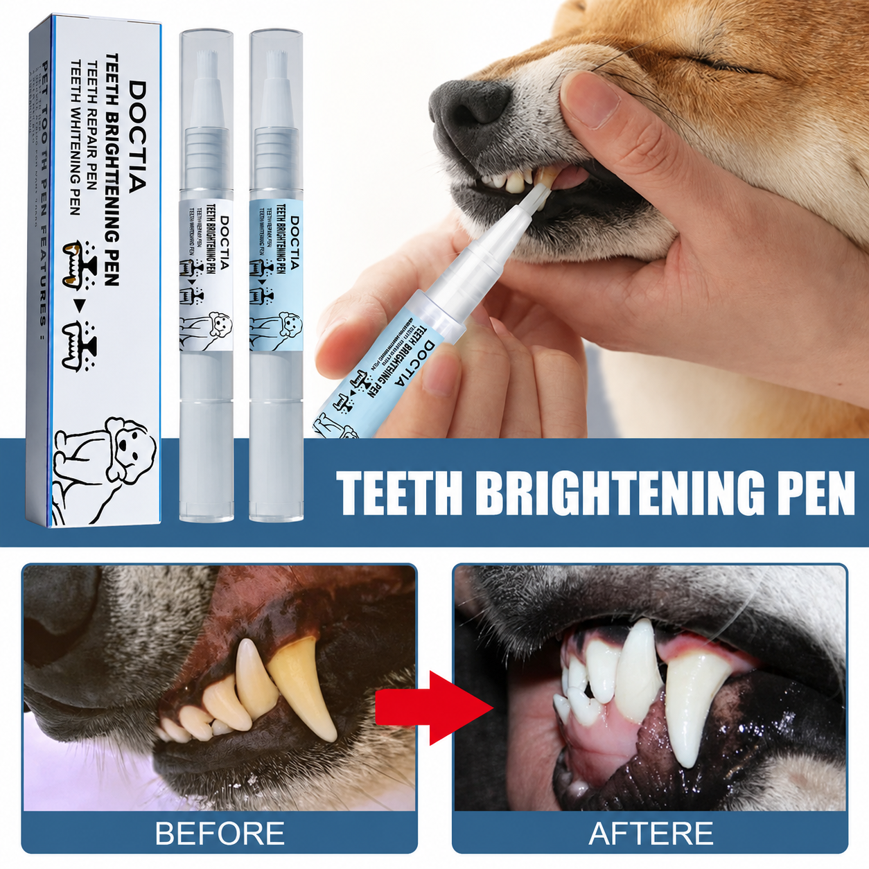 Tartar Remover Dental Stain Pen