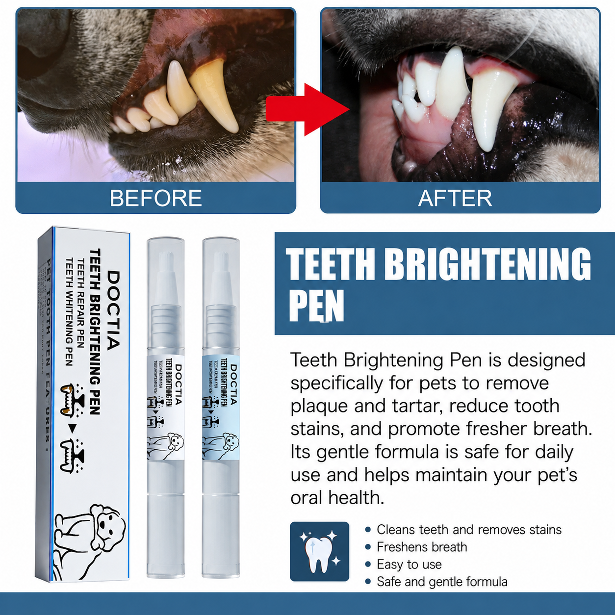 Tartar Remover Dental Stain Pen